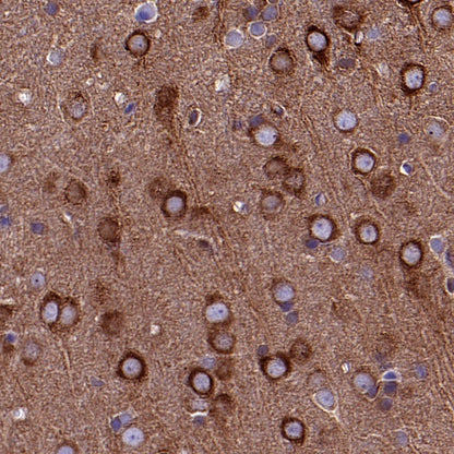 FAK Recombinant Rabbit mAb (S-1180-10)
