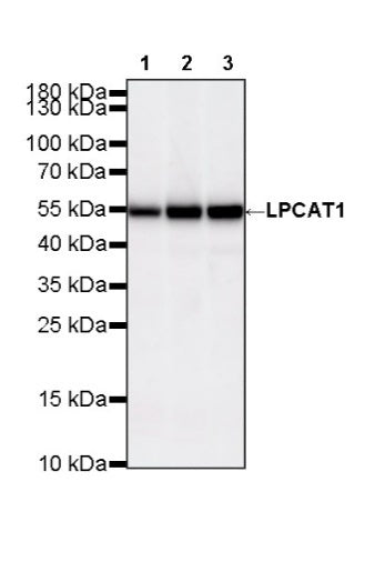 LPCAT1 Recombinant Rabbit mAb (S-6053)