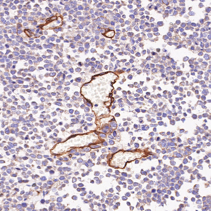 CD146 Recombinant Rabbit mAb (SDT-348-6)