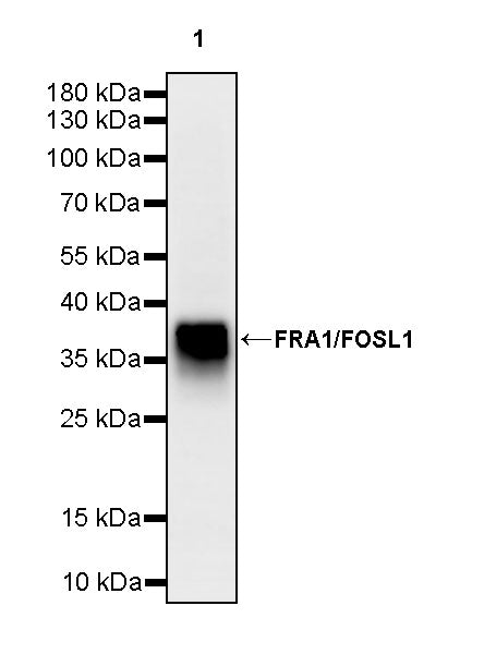 FRA1/FOSL1 Recombinant Rabbit mAb (S-3772-68)