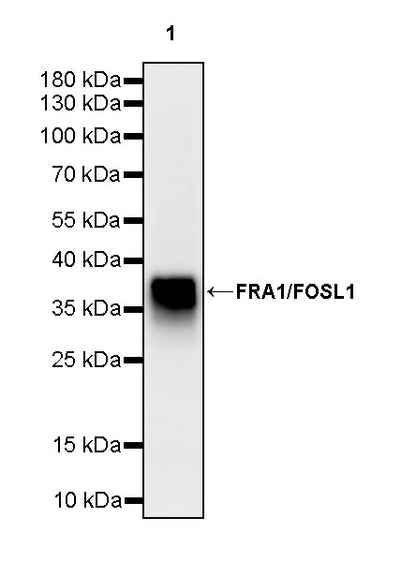 FRA1/FOSL1 Recombinant Rabbit mAb (S-3772-68)