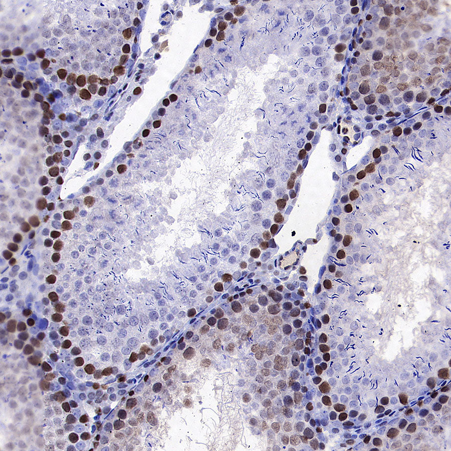 PCNA Recombinant Mouse mAb (S-5477)