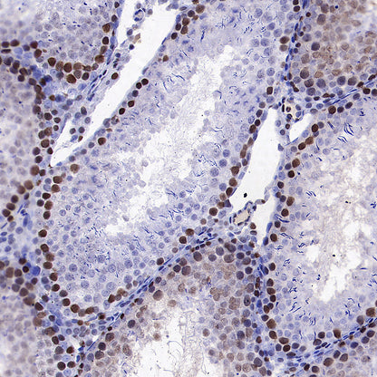 PCNA Recombinant Mouse mAb (S-5477)