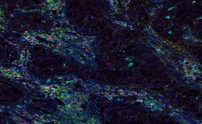 Absin 7-Color IHC Kit (Anti-Rabbit Secondary Antibody)