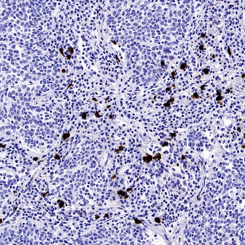 Human IgA1 Recombinant Rabbit mAb (S-2513-50)