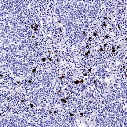 Human IgA1 Recombinant Rabbit mAb (S-2513-50)