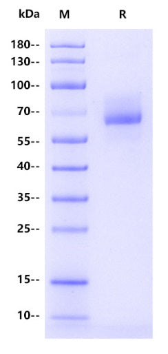 ALPL His Tag Protein, Human
