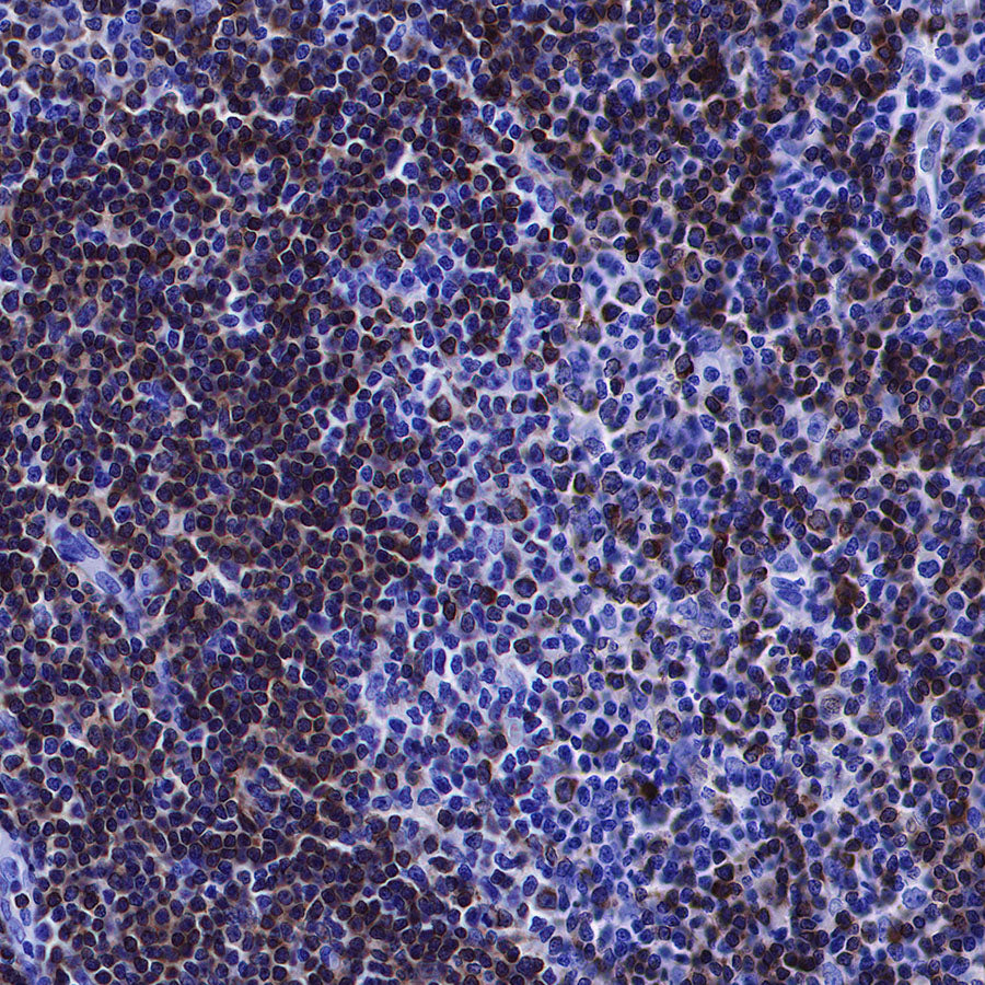 CD79a/MB-1 Recombinant Rabbit mAb (SDT-030-18)