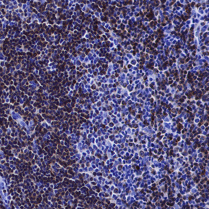 CD79a/MB-1 Recombinant Rabbit mAb (SDT-030-18)