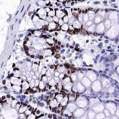 PCNA Recombinant Mouse mAb (S-5477)