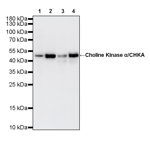 Choline Kinase α/CHKA Recombinant Rabbit mAb (S-4422-31)