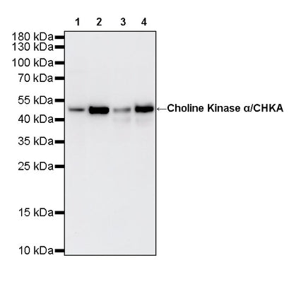 Choline Kinase α/CHKA Recombinant Rabbit mAb (S-4422-31)