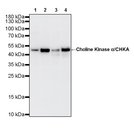 Choline Kinase α/CHKA Recombinant Rabbit mAb (S-4422-31)