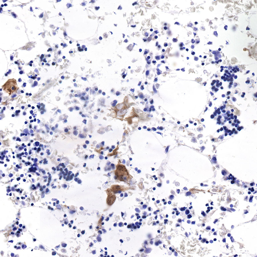 CD42b Recombinant Rabbit mAb (SDT-R147)