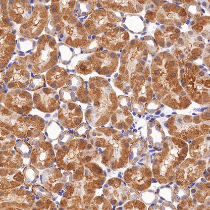 BRAF Recombinant Rabbit mAb (S-1328-60)