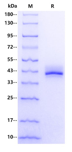 Human ADAM23 Protein, His tag