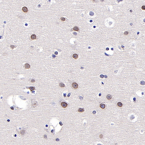 SUMO-1 Recombinant Rabbit mAb (S-625-111)