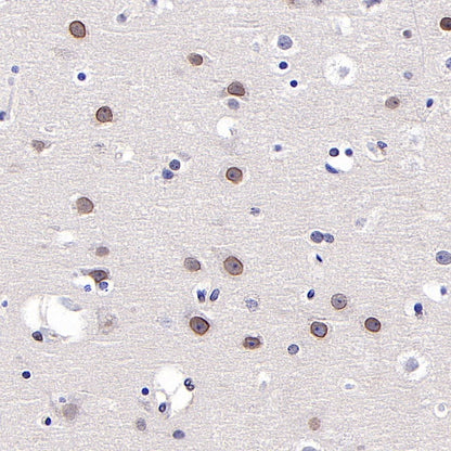 SUMO-1 Recombinant Rabbit mAb (S-625-111)