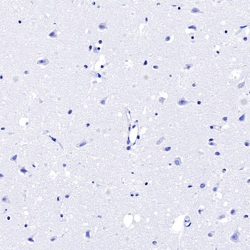 S-RMab® CGA/HCG-α Recombinant Rabbit mAb (SDT-643-61)