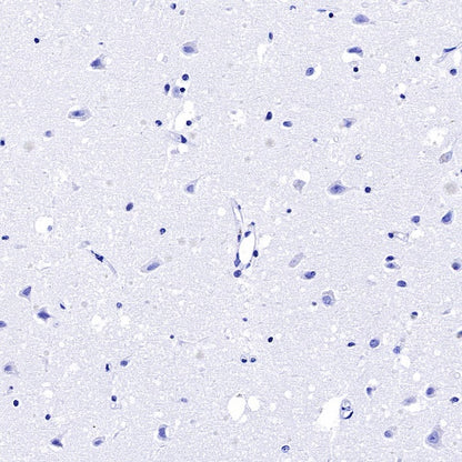 S-RMab® CGA/HCG-α Recombinant Rabbit mAb (SDT-643-61)