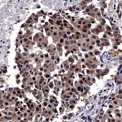 FTO Recombinant Rabbit mAb (S-1663-48)