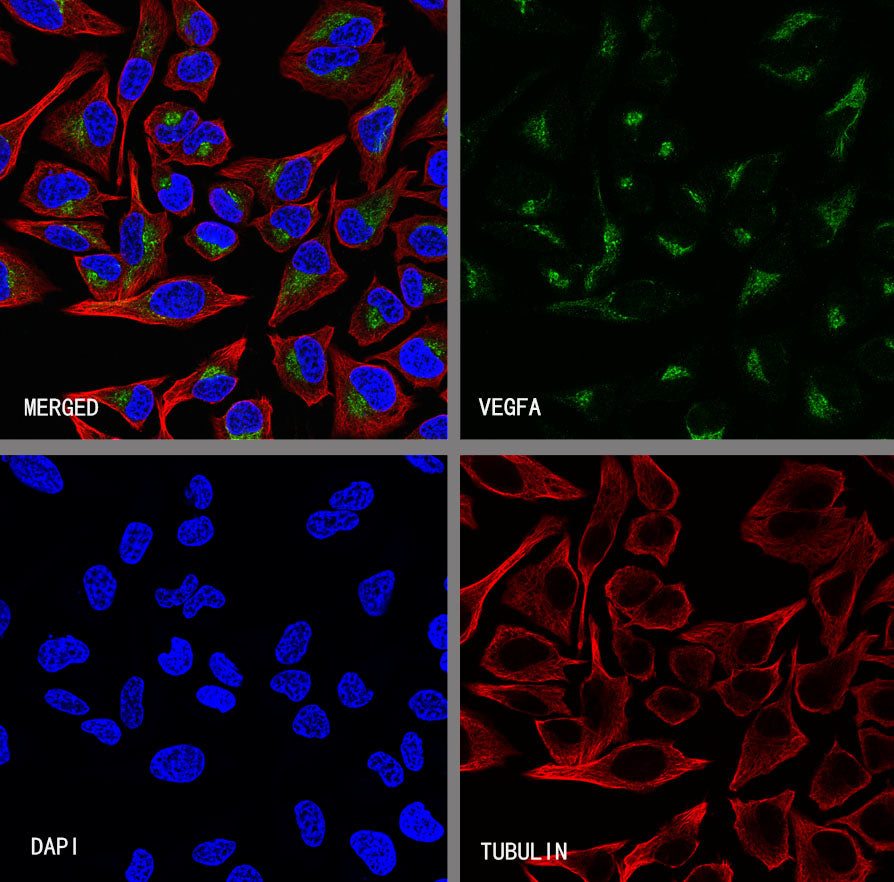 VEGFA Recombinant Rabbit mAb (S-5301)