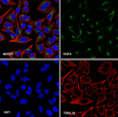 VEGFA Recombinant Rabbit mAb (S-5301)