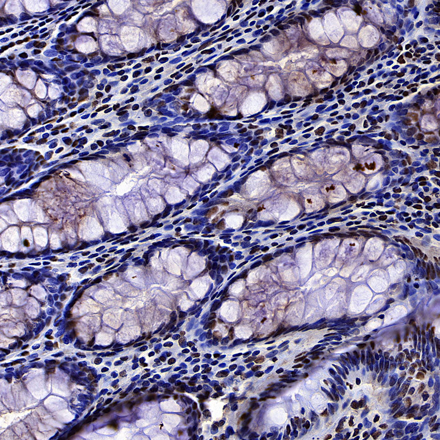EIF4A3 Mouse mAb