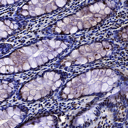 EIF4A3 Mouse mAb