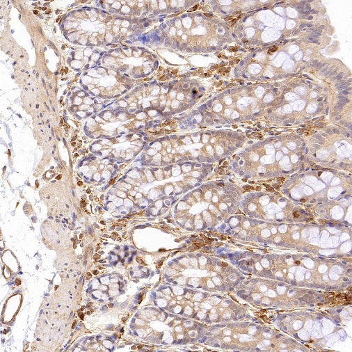 Talin-1 Recombinant Rabbit mAb (S-1483-25)