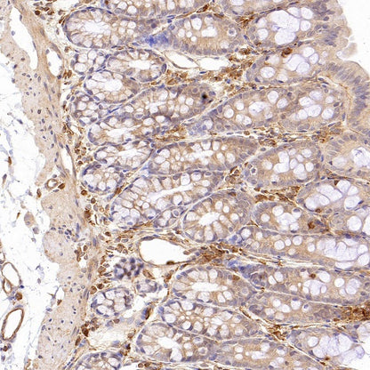 Talin-1 Recombinant Rabbit mAb (S-1483-25)