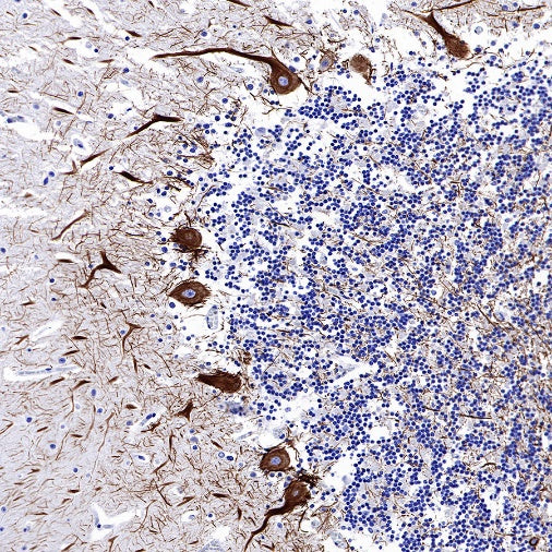 Neurofilament H Recombinant Rabbit mAb (S-532-103)