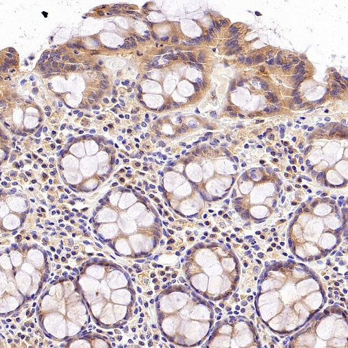 Rab5 Recombinant Rabbit mAb (S-1506-128)