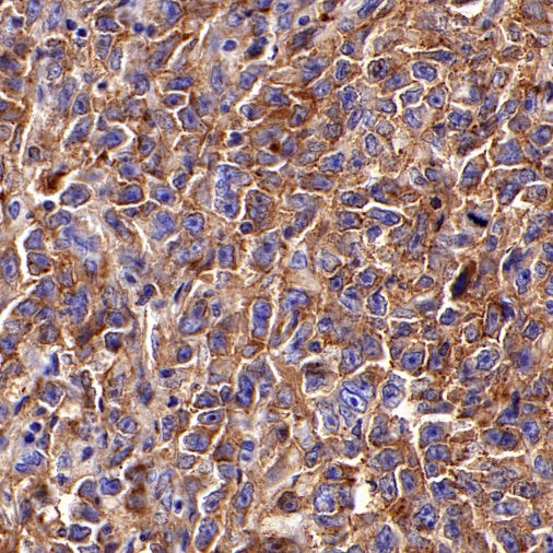 HLA-DRB1 Recombinant Rabbit mAb (SDT-R253)