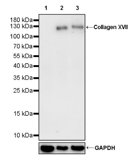 Collagen XVII Recombinant Rabbit mAb (S-1636-5)