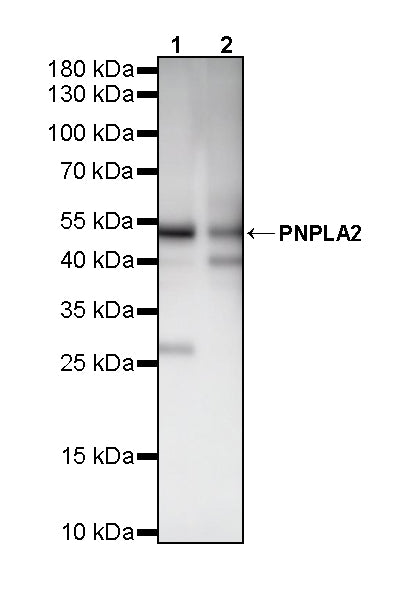PNPLA2 Recombinant Rabbit mAb (S-5409)