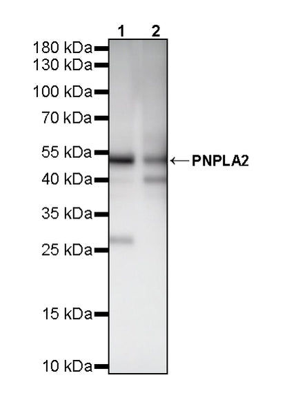 PNPLA2 Recombinant Rabbit mAb (S-5409)
