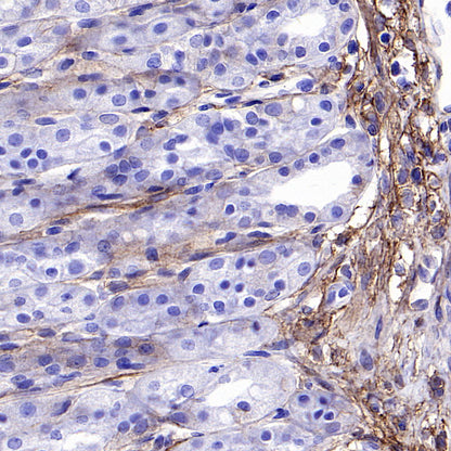 PTK7 Recombinant Rabbit mAb (SDT-2432-136)