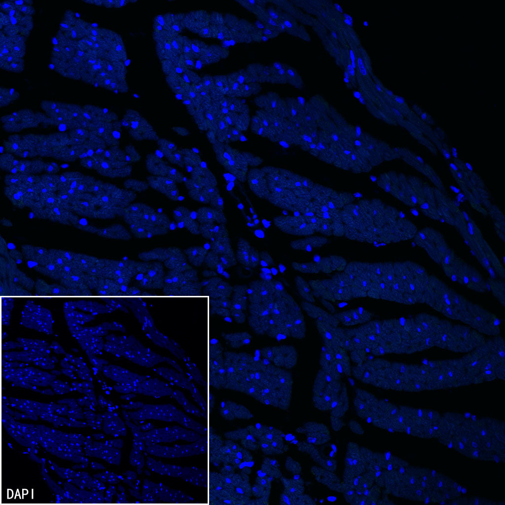 H+/K+-ATPase Recombinant Rabbit mAb (S-3474-110)