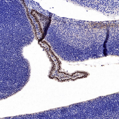 OTX2 Recombinant Rabbit mAb (S-2095-8)