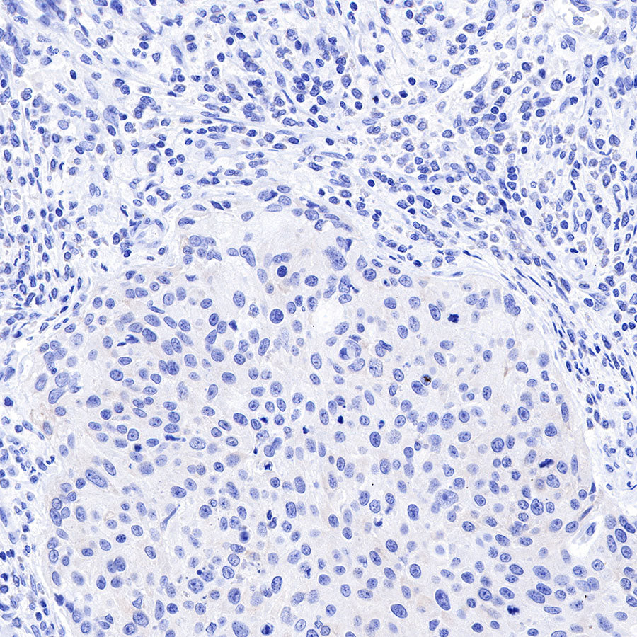 Keratin 18 Recombinant Rabbit mAb (SDT-R081)