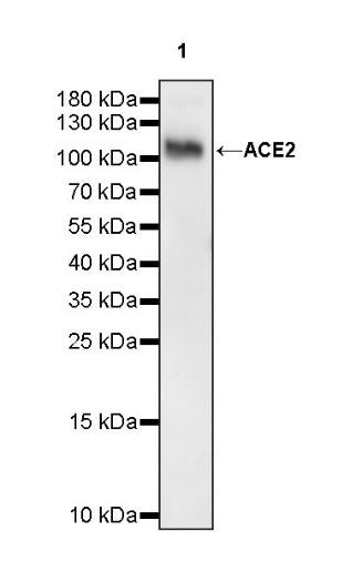 ACE2 Recombinant Rabbit mAb (S-1348-7)