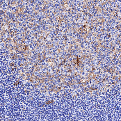 CD63 Recombinant Rabbit mAb,PBS Only (SDT-230-3)