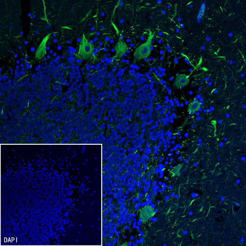 Neurofilament H Recombinant Rabbit mAb (S-532-103)