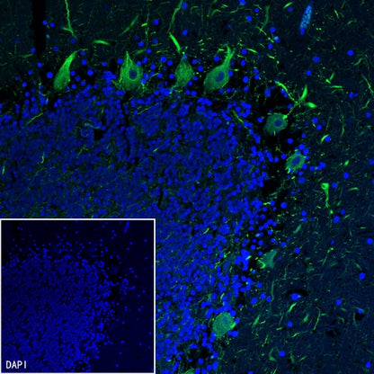 Neurofilament H Recombinant Rabbit mAb (S-532-103)