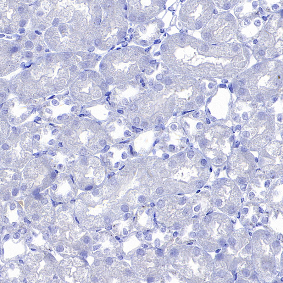 Hepatocyte Specific Antigen Recombinant Mouse mAb (SDT-4389)