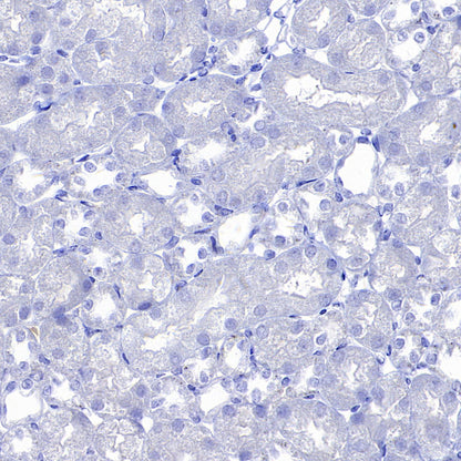 Hepatocyte Specific Antigen Recombinant Mouse mAb (SDT-4389)