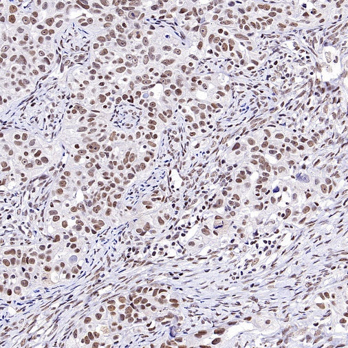 SMARCAL1 Recombinant Rabbit mAb (S-2110-328)