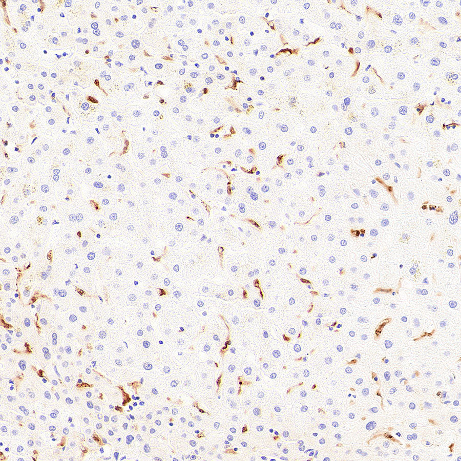 Galectin-9 Recombinant Rabbit mAb (S-4579-67)