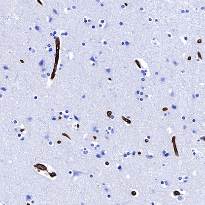 S-RMab® GLUT1 Recombinant Rabbit mAb (SDT-047-53)